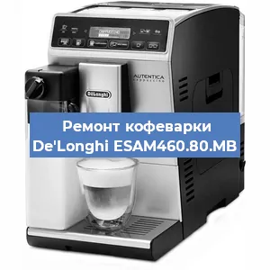 Замена | Ремонт мультиклапана на кофемашине De'Longhi ESAM460.80.MB в Воронеже